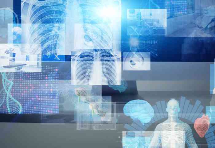 Various views of imaging, from a x-ray of lungs to a digital view of a heart.